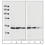 Western blot detection of VRK1 in the crude extracts of human cells. Lanes 1, 2, 3; HeLa cell extract (5x104 cells) with antibody dilutions at 1/100, 1/500, 1/1000. Lanes 4, 5, 6; U2OS cell extract (5x104 cells) with the antibody dilutions at 1/100, 1/500, 1/1,000. As secondary antibody, Alexa488 goat anti-mouse IgG was used. ImmunoStar?R LD (Wako, Tokyo) was used as chemiluminescence reagent and images were taken with BIO-RAD ChemiDocXRS