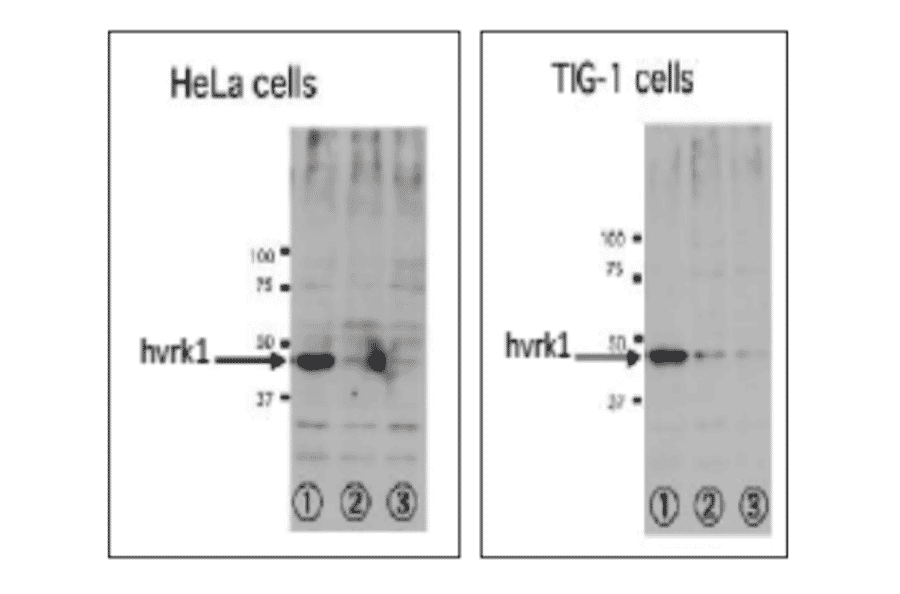 Inhibition of VRK1 expression in human cells treated by RNAi. specific to VRK1.