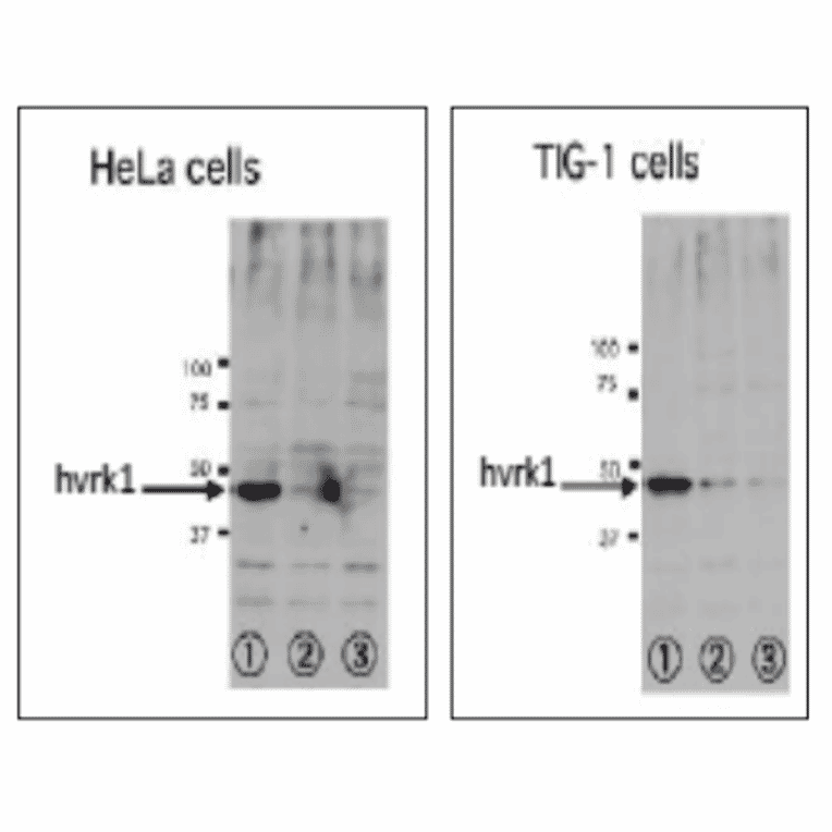 Inhibition of VRK1 expression in human cells treated by RNAi. specific to VRK1.