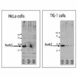 Inhibition of VRK1 expression in human cells treated by RNAi. specific to VRK1.