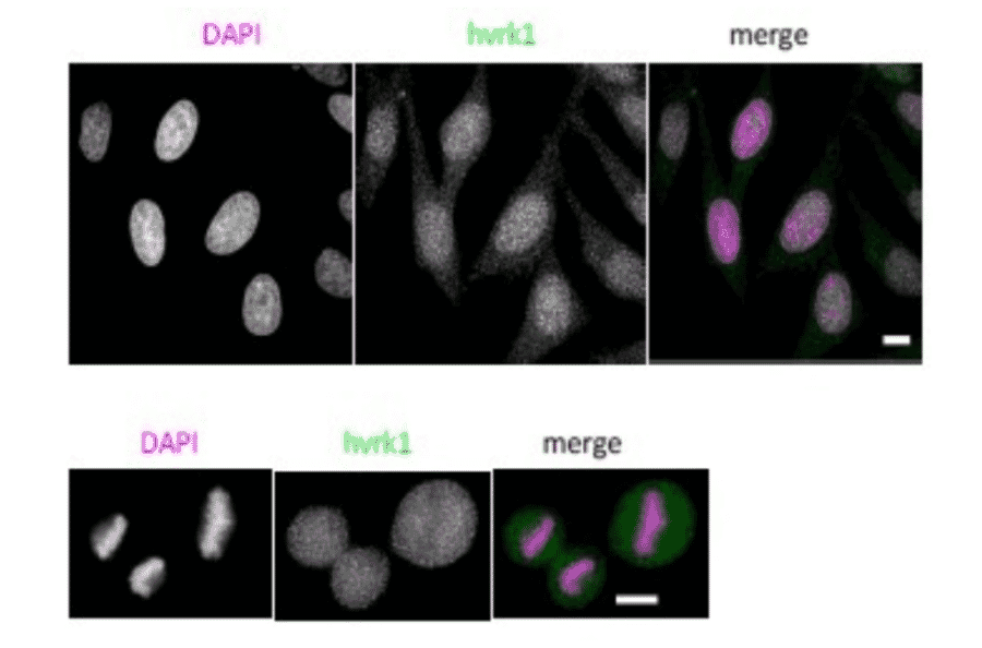 Immunoflorescence staining of VRK1 in HeLa cells, PA fixed.