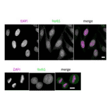 Immunoflorescence staining of VRK1 in HeLa cells, PA fixed.