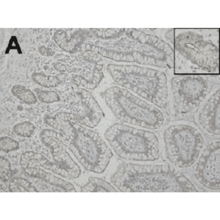 Immunohistochemical staining of FceRa in section from intestinal tissue.