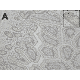 Immunohistochemical staining of FceRa in section from intestinal tissue.