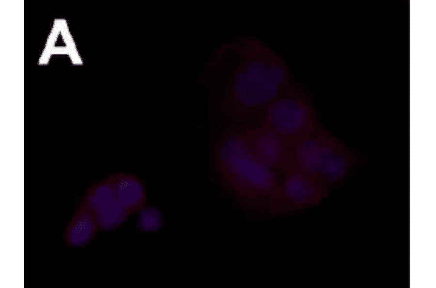 Immunofluorescence staining of FceRa in human intestinal tumor cell line.