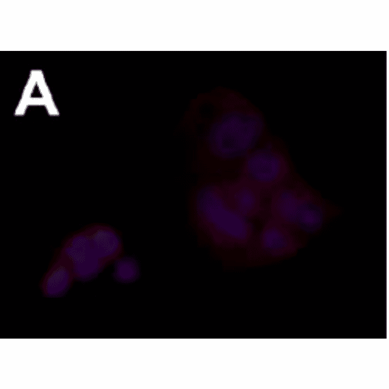 Immunofluorescence staining of FceRa in human intestinal tumor cell line.