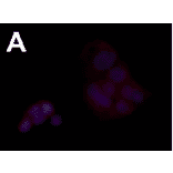 Immunofluorescence staining of FceRa in human intestinal tumor cell line.