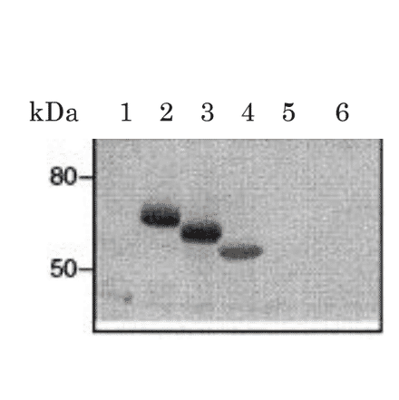 Epitope manpping of clone CRA2 of antiFceR1a monoclonal antibody by western blotting.