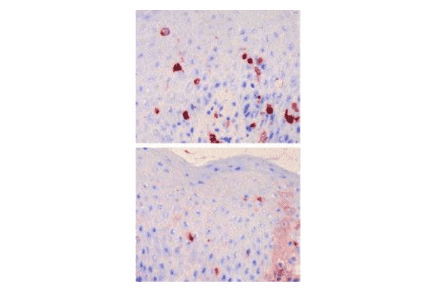 IHC - Anti-FCER1A Antibody [CRA2] (A420)