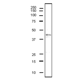 Detection of human CD40 in whole cell extract of MCF7 by western blot using anti-CD40 antibody (clone 5C3).
