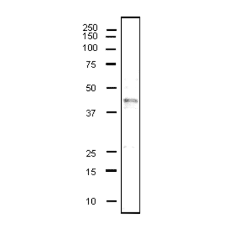 Detection of human CD40 in whole cell extract of MCF7 by western blot using anti-CD40 antibody (clone 5C3).