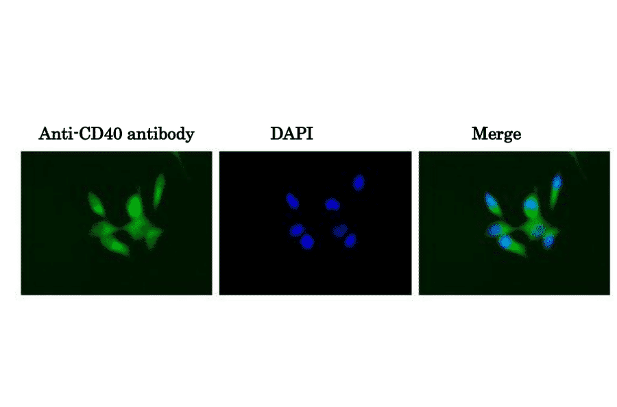 Immunofluorescent staining of CD40 in MCF7 cells with anti-CD40 antibody (5C3)