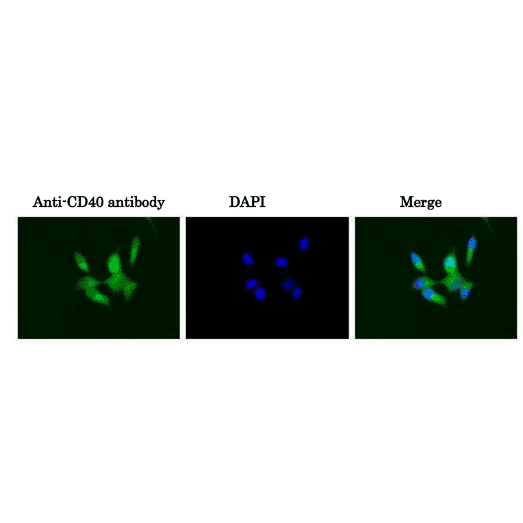 Immunofluorescent staining of CD40 in MCF7 cells with anti-CD40 antibody (5C3)