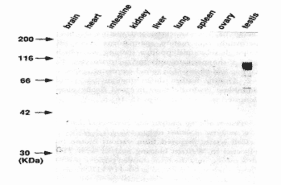 Western blot analysis with TRA98 of various mouse tissues.