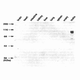 Western blot analysis with TRA98 of various mouse tissues.