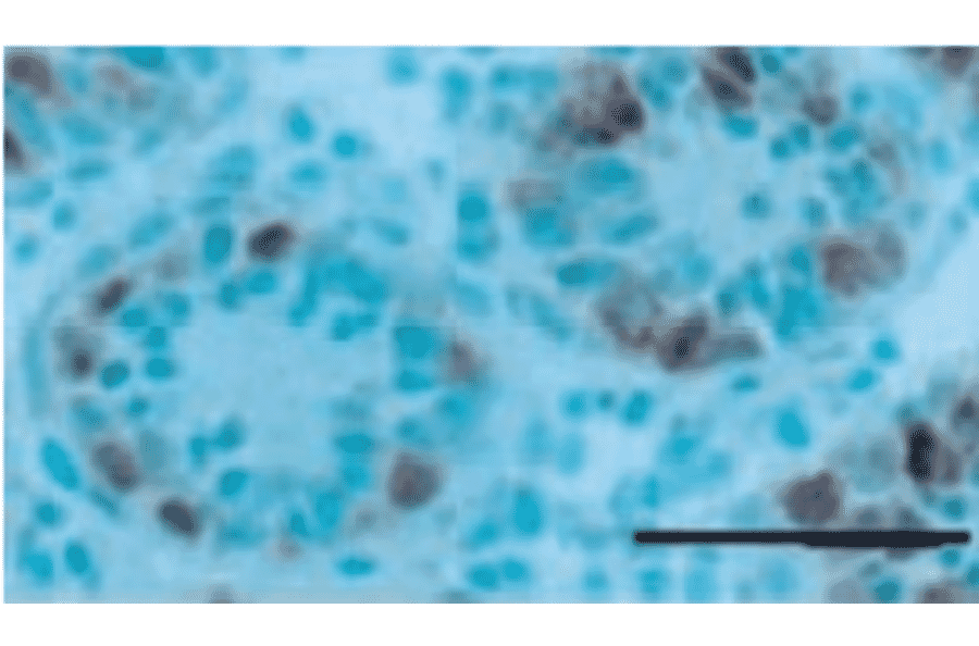 Immunohistochemical staining of a 7-day-old testis with germ cell-specific antibody, TRA98. 