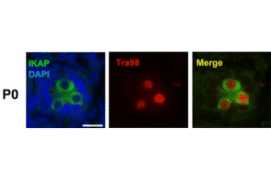 Colocalization of germ cell specific marker, Tra98, with IKAP at PO during spermatogenesis as shown by imunohistological staining.