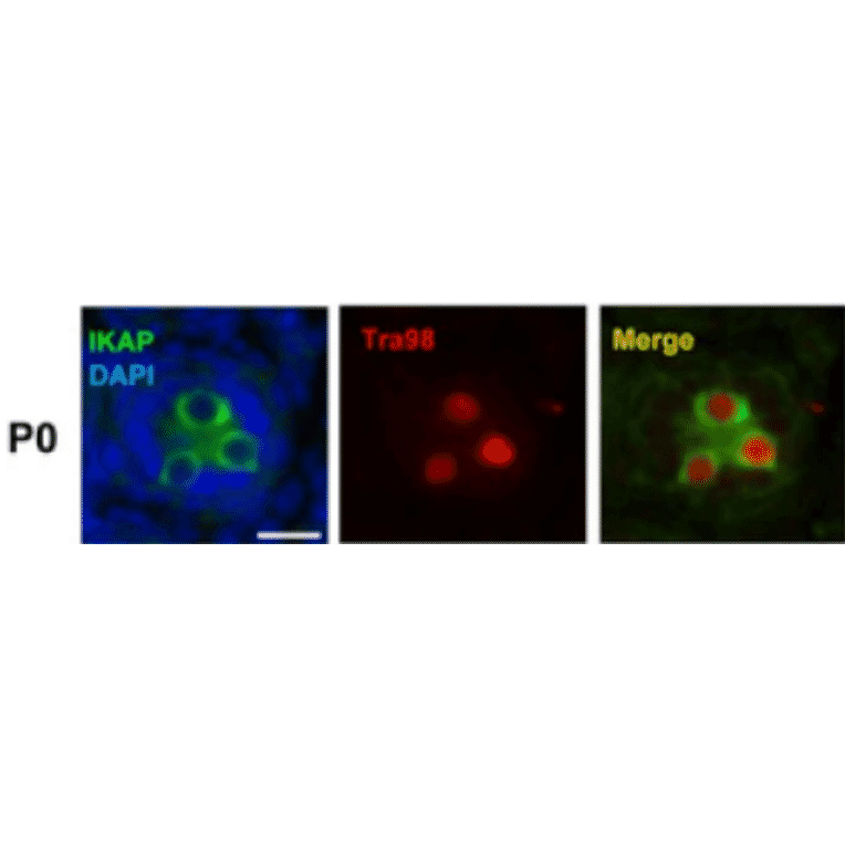 Colocalization of germ cell specific marker, Tra98, with IKAP at PO during spermatogenesis as shown by imunohistological staining.