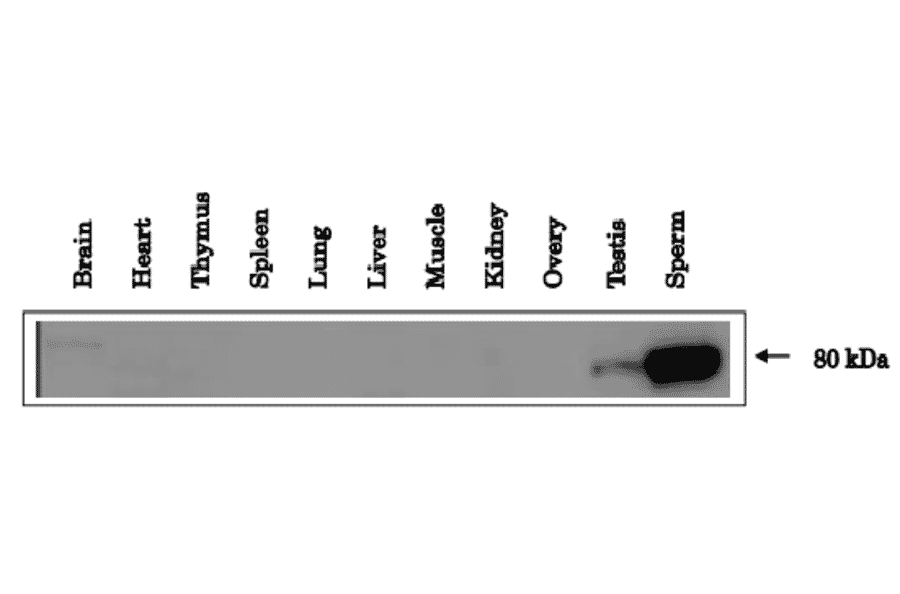 Expression of ACE3 in Testis and sperm of mouse as identified by western blotting with anti-ACE3 antibody.