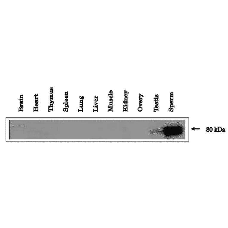 Expression of ACE3 in Testis and sperm of mouse as identified by western blotting with anti-ACE3 antibody.