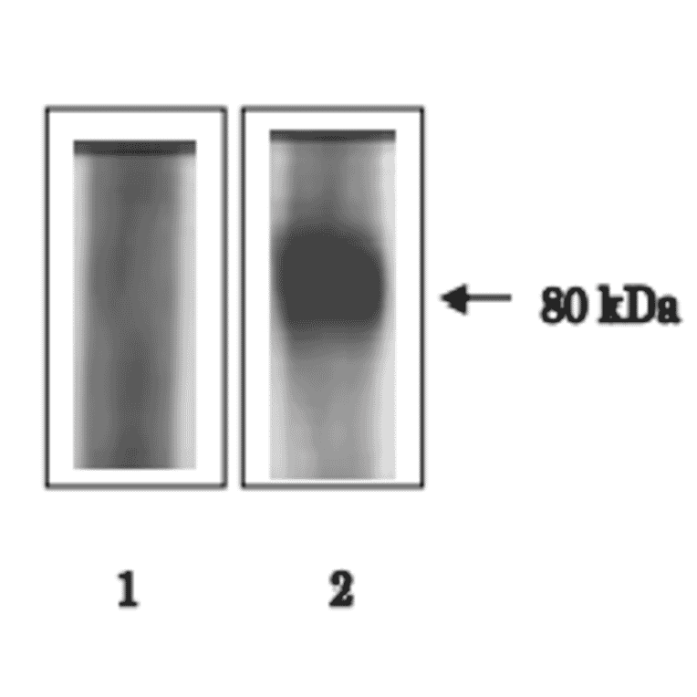 Immunoprecipitation of ACE3 protein from sperm lysate.