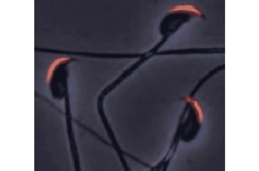 Subcellular localization of ACE3 protein in sperm.