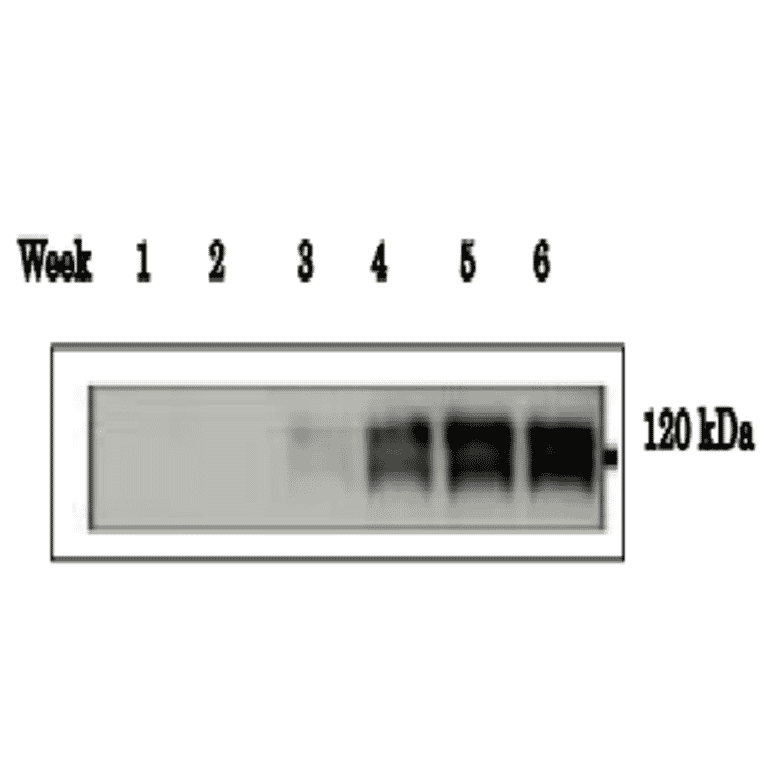Immunohistological staining of ADAM1B in mouse testis using anti-ADAM1B antibody