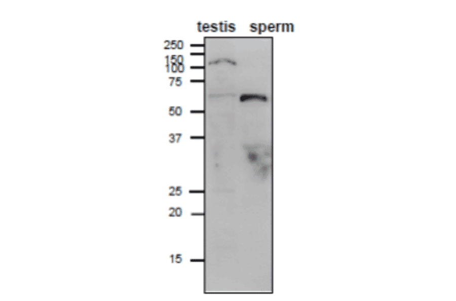 Weatern blot analysis of Adam1B in mouse testis and sperm lysates. 