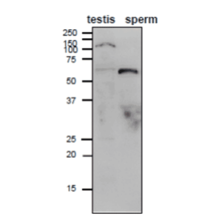 Weatern blot analysis of Adam1B in mouse testis and sperm lysates. 