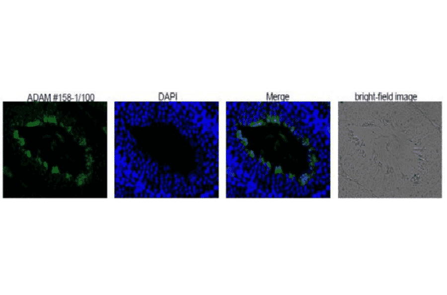 Differentiation stage-specific expression of ADAM1B in mouse testis as examined by Western blotting with anti-ADAM1B antibody. 