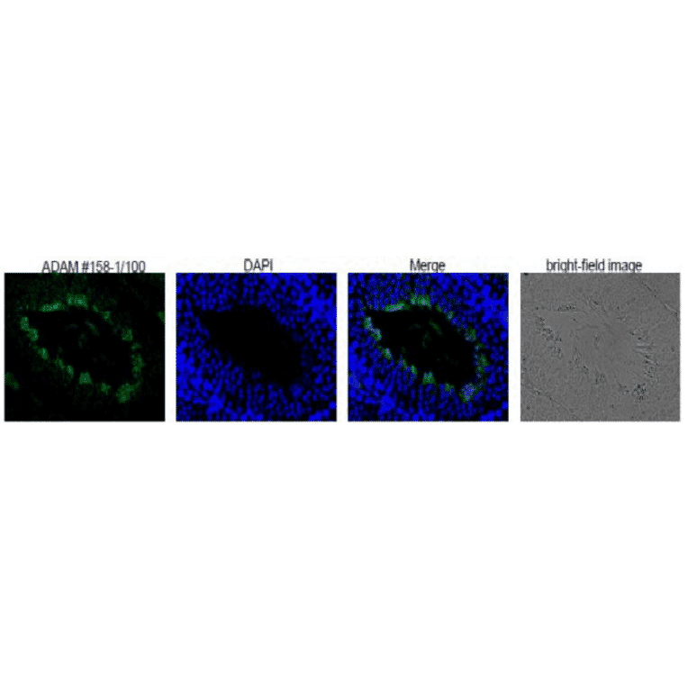 Differentiation stage-specific expression of ADAM1B in mouse testis as examined by Western blotting with anti-ADAM1B antibody. 