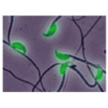 Immunofluorescent staining of ADAM1B in sperm by using anti-ADAM1B antibody. 