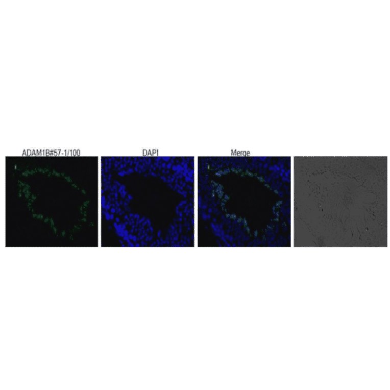 Immunohistological staining of ADAM1B in mouse testis using anti-ADAM1B antibody 