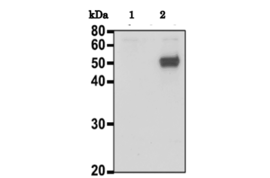 Identification of CALR protein by western blotting with anti-CALR antibody. 