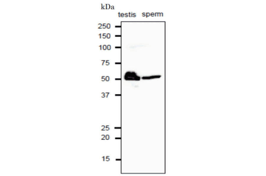 Western blot analysis of CALR protein in crude extracts of mouse testis and sperm with anti-CALR antibody. 