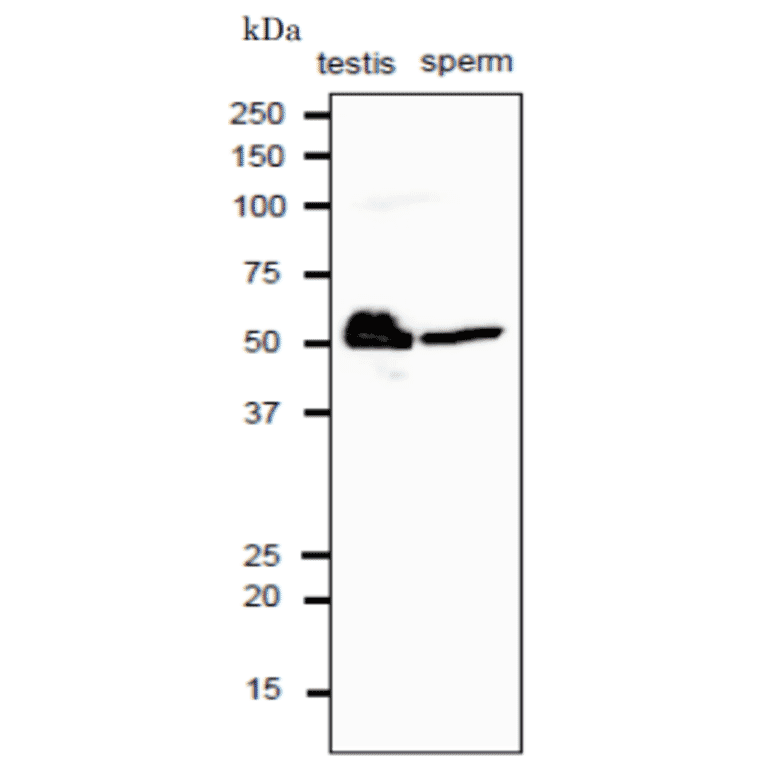 Western blot analysis of CALR protein in crude extracts of mouse testis and sperm with anti-CALR antibody. 