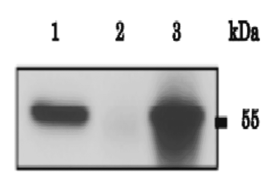 Immunoprecipitation of CALR protein with anti-CALR antibody.