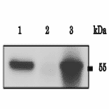 Immunoprecipitation of CALR protein with anti-CALR antibody.