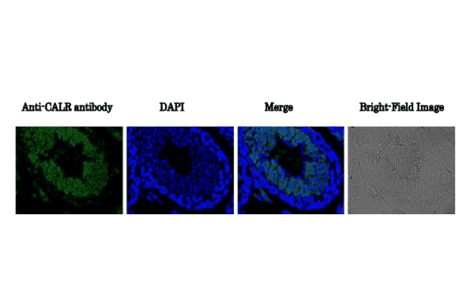 Immunohistological staining of CALR protein in mouse testis using anti-CALR antibody.