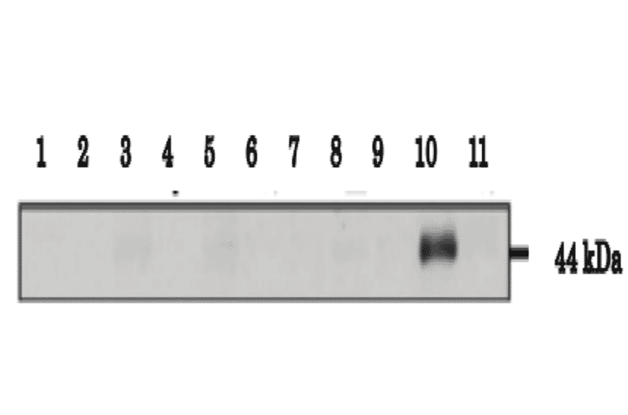 Testeis specific expression of Calreticulon-3 as examined in various tissues by western blotting with anti-CALR3 antibody.