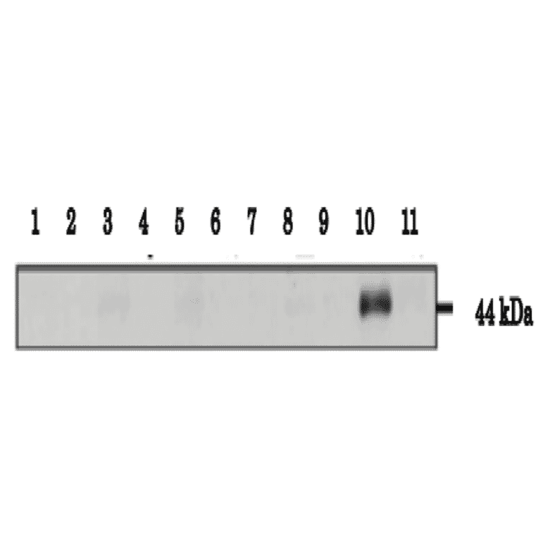 Testeis specific expression of Calreticulon-3 as examined in various tissues by western blotting with anti-CALR3 antibody.