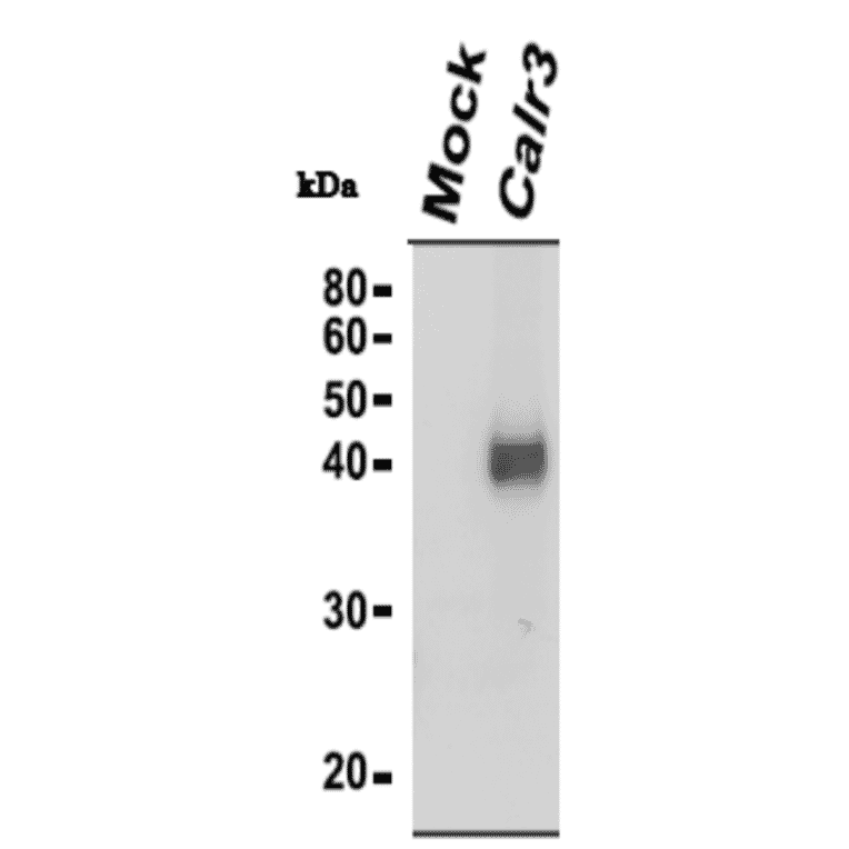 Identification of Calreticulon-3 protein by western blotting with anti-CALR3 antibody.