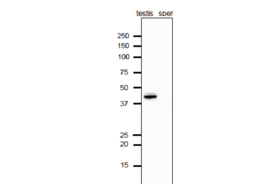 Analysis of Calrecticulon-3 protein in the extracts of mouse testis and sperm by western blotting with anti-Calrecticulon-3 antibody