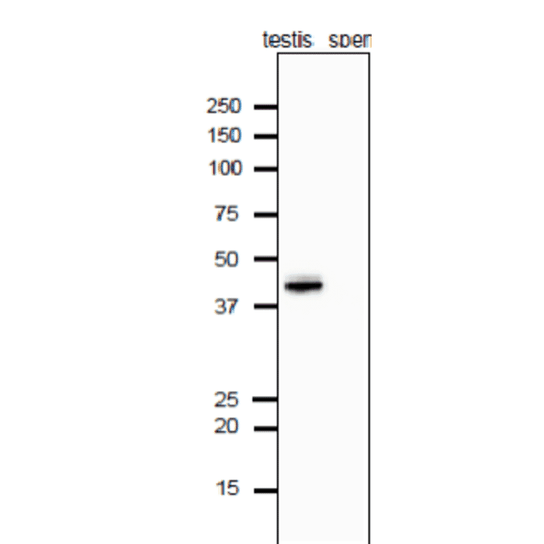Analysis of Calrecticulon-3 protein in the extracts of mouse testis and sperm by western blotting with anti-Calrecticulon-3 antibody