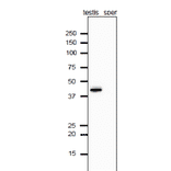 Analysis of Calrecticulon-3 protein in the extracts of mouse testis and sperm by western blotting with anti-Calrecticulon-3 antibody