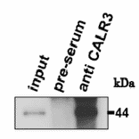 Immunoprecipitation of Calreticulon-3 protein with anti-CALR3 antibody