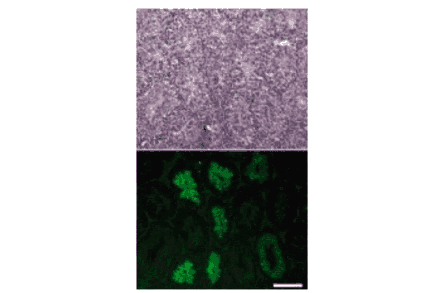 Immunofluorescence staining of a testicular section with anti-CALR3 antibody.