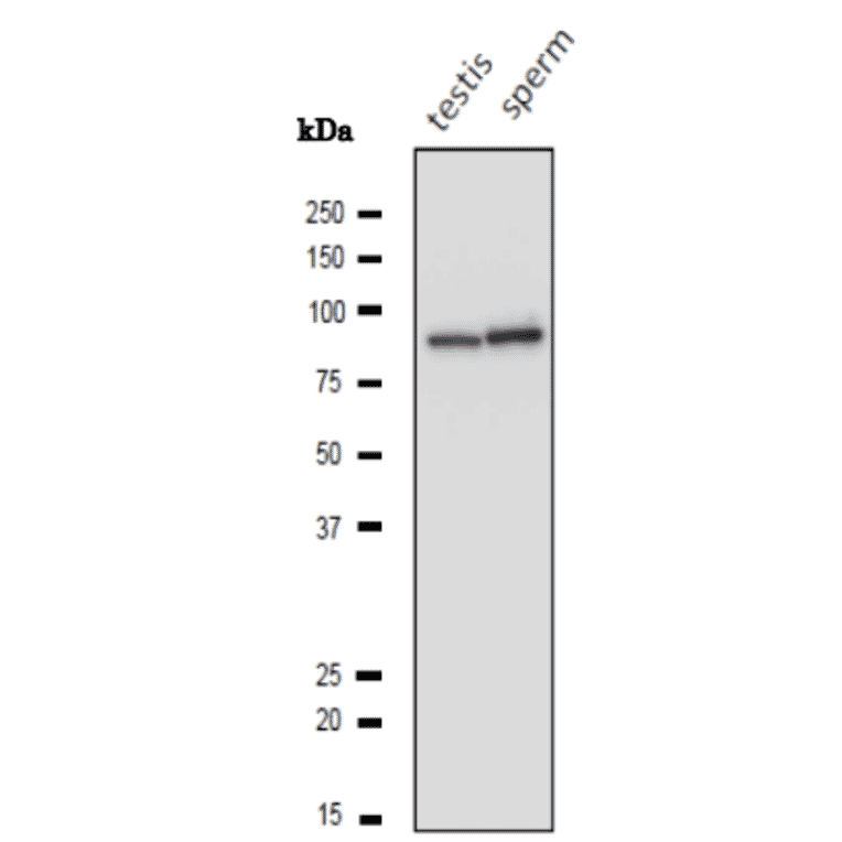 Western blotting analysis of lysatess of mouse testis and sperm with anti-Calnexin (CANX) antibody.