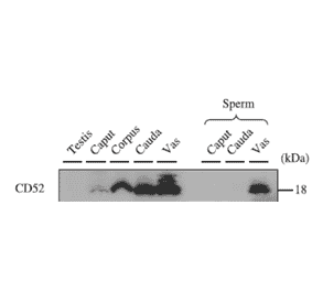 Western blotting analysis of CD52 expression in various tissues with anti-CD52 antibody.