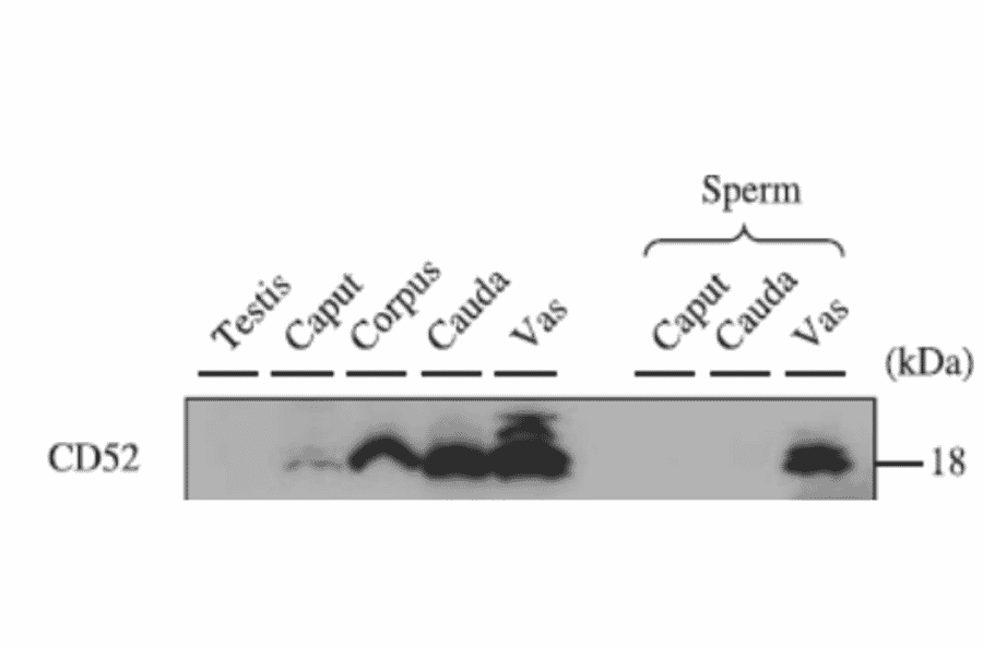 Western blotting analysis of CD52 expression in various tissues with anti-CD52 antibody.